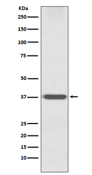 Otx1 Rabbit mAb Antibody