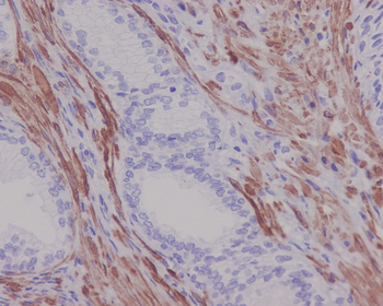 Desmin Rabbit Monoclonal Antibody