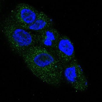 NGF Rabbit mAb Antibody