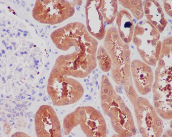 NGF Rabbit mAb Antibody