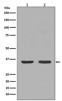 NGF Rabbit mAb Antibody
