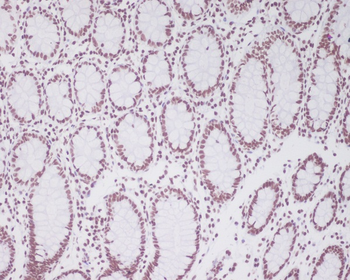 Pax2 Rabbit mAb Antibody