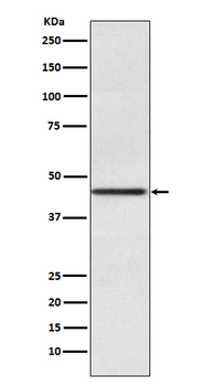 Pax2 Rabbit mAb Antibody
