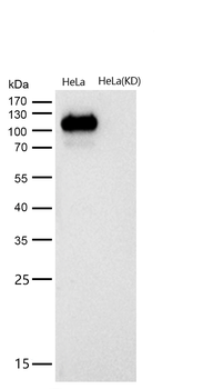 CD146 Rabbit mAb [KD Validated]