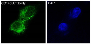 CD146 Rabbit mAb [KD Validated]