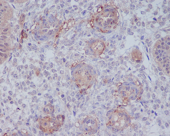 CD146 Rabbit mAb [KD Validated]