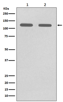 CD146 Rabbit mAb [KD Validated]