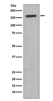 CD11b Rabbit mAb Antibody