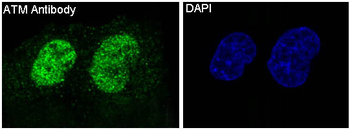 ATM Rabbit mAb Antibody