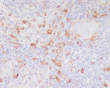 CD11c Rabbit mAb Antibody
