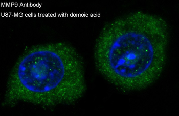 MMP9 Rabbit mAb Antibody