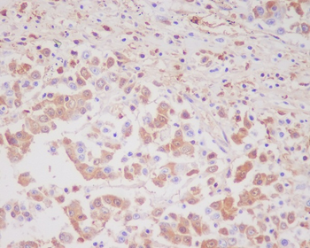 MMP9 Rabbit mAb Antibody