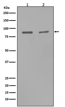MMP9 Rabbit mAb Antibody
