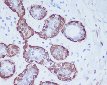 Calponin Rabbit mAb Antibody