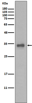 Calponin Rabbit mAb Antibody