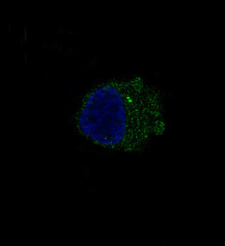 S100B Rabbit mAb Antibody