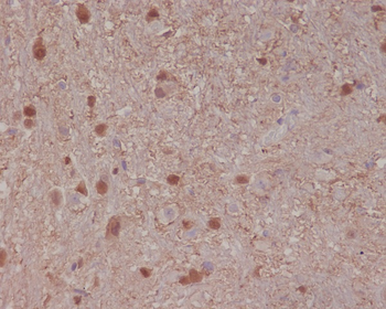 S100B Rabbit mAb Antibody