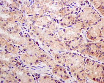 MCL1 Rabbit mAb Antibody