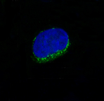CD34 Rabbit mAb Antibody