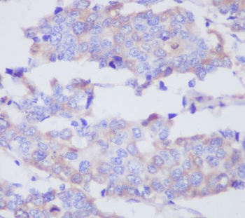 MMP2 Rabbit mAb Antibody
