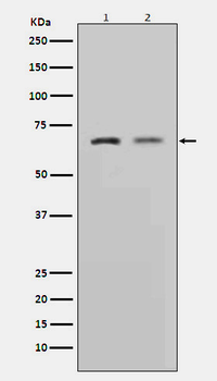 MMP2 Rabbit mAb Antibody
