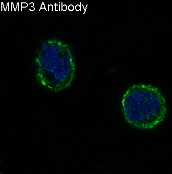 MMP3 Rabbit mAb Antibody