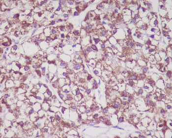 MMP3 Rabbit mAb Antibody