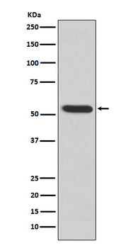 MMP3 Rabbit mAb Antibody