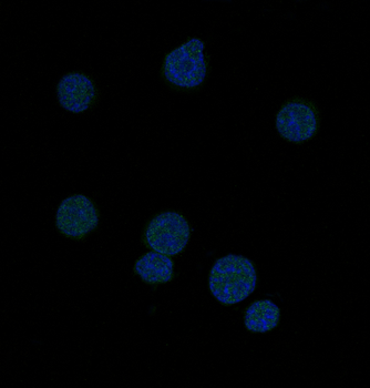 Bcl-6 Rabbit mAb Antibody