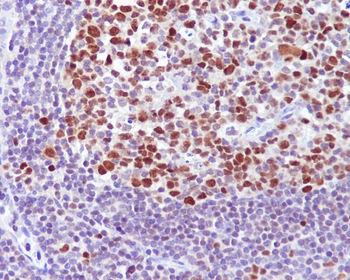 Bcl-6 Rabbit mAb Antibody