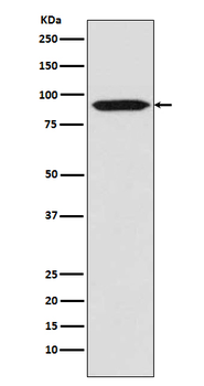 Bcl-6 Rabbit mAb Antibody