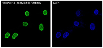 Histone H3 (acetyl K56) Rabbit mAb [KD Validated]