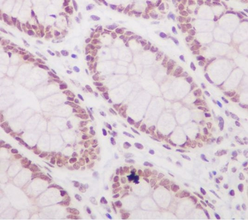 Histone H3 (acetyl K56) Rabbit mAb [KD Validated]