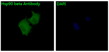 Hsp90 beta Rabbit mAb [KD Validated]