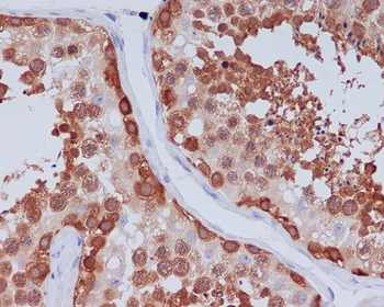 Hsp90 beta Rabbit mAb [KD Validated]