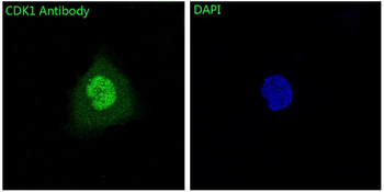 CDK1 Rabbit mAb Antibody