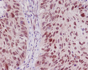 TRAF6 Rabbit mAb Antibody
