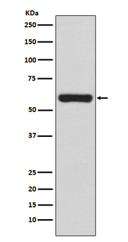 TRAF6 Rabbit mAb Antibody