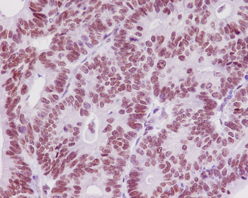 TRAF6 Rabbit mAb Antibody
