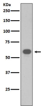 TRAF6 Rabbit mAb Antibody