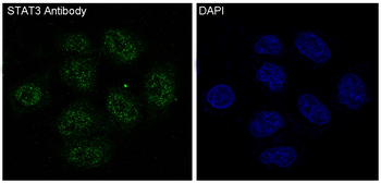 STAT3 Rabbit mAb Antibody