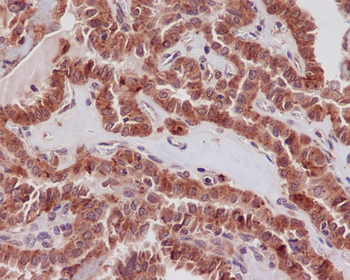STAT3 Rabbit mAb Antibody