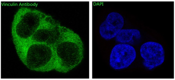 Vinculin Rabbit mAb Antibody