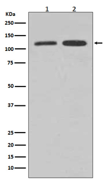 Vinculin Rabbit mAb Antibody