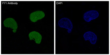 YY1 Rabbit mAb Antibody