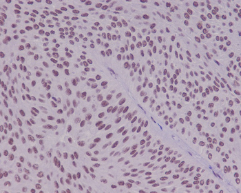 YY1 Rabbit mAb Antibody
