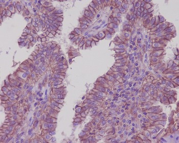 Sodium Potassium ATPase Rabbit mAb
