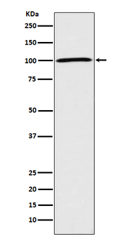 Sodium Potassium ATPase Rabbit mAb