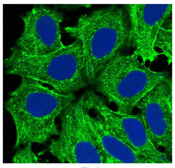 Actin (Alpha-Actin) Rabbit mAb Antibody