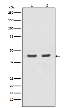 Actin (Alpha-Actin) Rabbit mAb